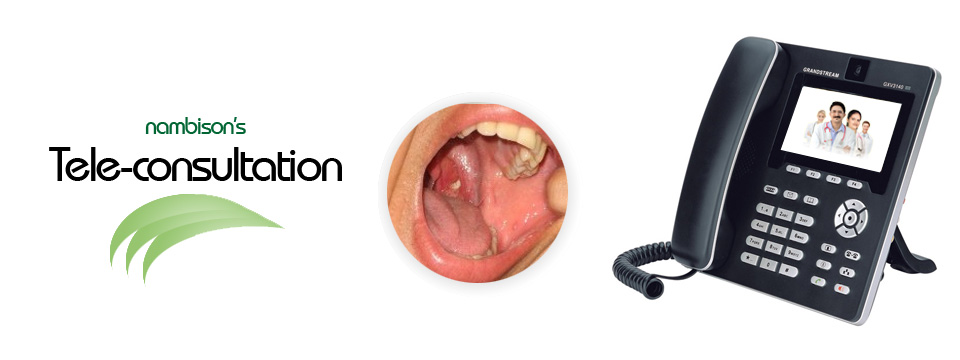 Unbearable throat pain: Teleconsultation cure